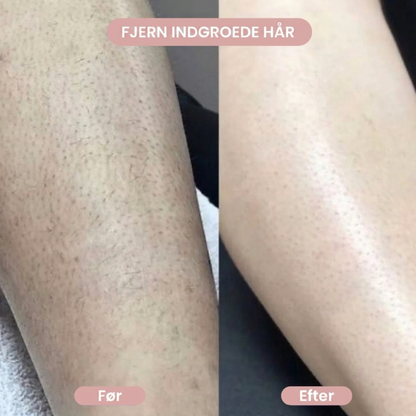 GlowShave™ – 2-i-1 bodyshaver til kvinder