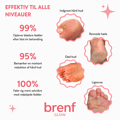 ✨ HoneyGlow™ – Skønhedssæt til Fødder
